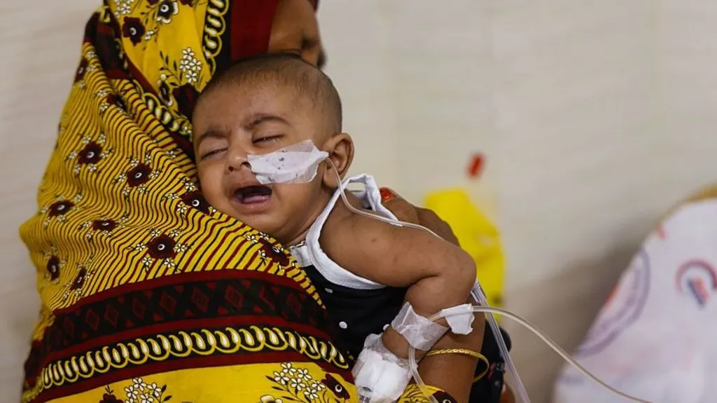 भयावह प्रकोप बन्दै बंगलादेशमा दादुरा, एक हजारभन्दा बढी बालबालिकाको मृत्यु